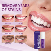 Teeth Brightening Hismiles V34